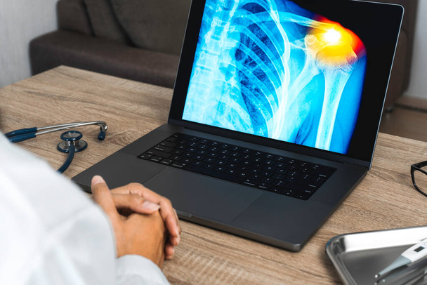 Doctor looking a x-ray of pain in the shoulder on a laptop. . High quality photo - Foto, imagen