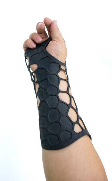 Ortopedyczna proteza z tworzywa sztucznego wydrukowana na druku proszkowym 3D pod ręką. Odizolowany na białym tle. Zbliżenie gipsu. Technologia druku 3D Multi Jet Fusion MJF. Nowoczesna postępowa technologia addytywna - Zdjęcie, obraz