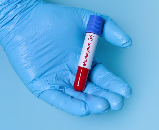 Doctor holding a test blood sample tube positive with Monkeypox virus (MPXV) .The virus is transmitted from animals to humans. Infected people suffer from fever, cough, headache, nausea and vomiting. Banner. Copy space for text. - Foto, afbeelding