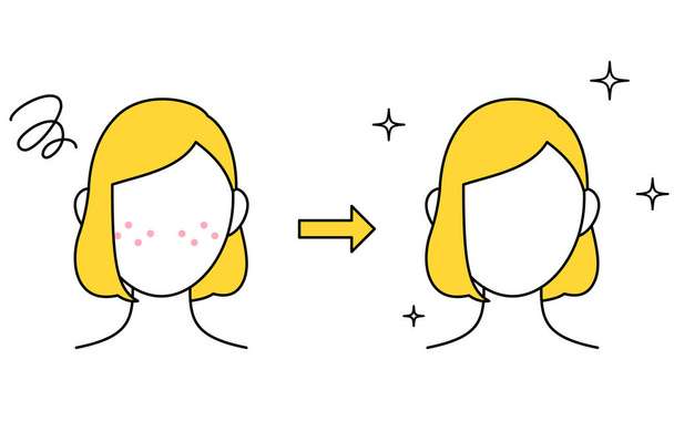 Beauty, Image of women's skin care, from acne skin to smooth skin - Vetor, Imagem