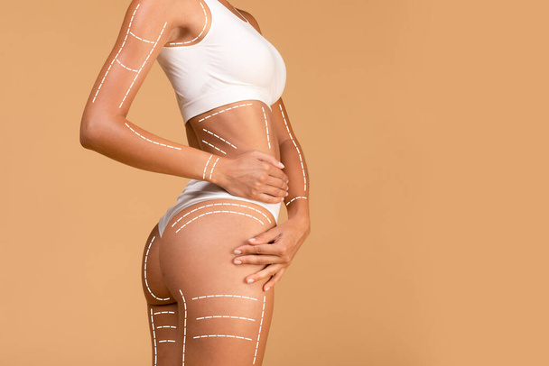 Lifting and tightening concept. Young lady in white top and panties posing with massage lines and arrows on her body over beige studio background, free space - Foto, Imagen