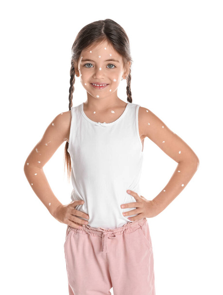 Little girl with chickenpox on white background - Fotoğraf, Görsel
