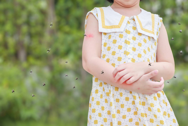 Κοριτσάκι έχει δερματικό εξάνθημα αλλεργία φαγούρα και ξύσιμο στο χέρι της με τα κουνούπια δάγκωμα - Φωτογραφία, εικόνα