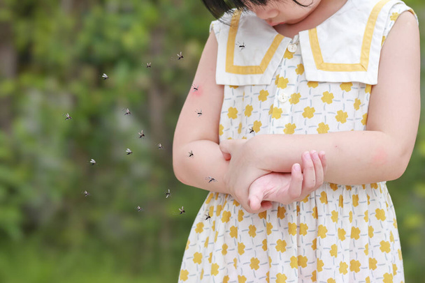 Little girl has skin rash allergy itching and scratching on her arm with mosquitoes bite - Zdjęcie, obraz