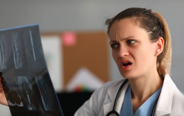 Female doctor looks in amazement and shock at x-ray of spine. X-ray images of lungs concept - Zdjęcie, obraz