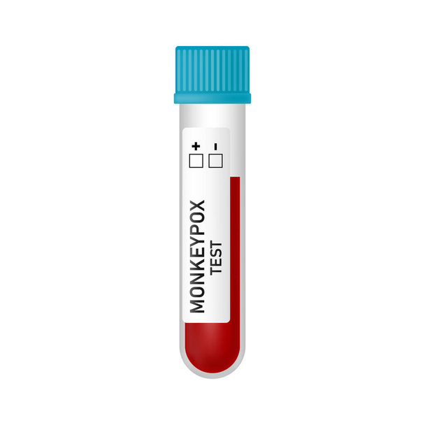 Blood sample tube with Monkeypox virus test isolated on white background. Vector realistic illustration. Design for medical banner, flyer, card, infographic - Vektor, obrázek