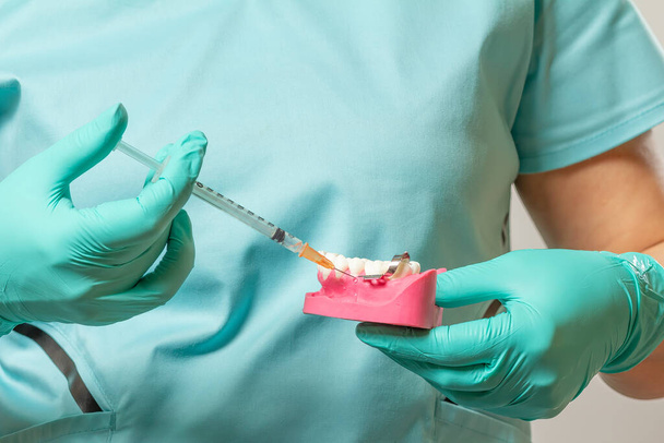 Ręce dentysty trzymające układ szczęki i strzykawkę ze środkiem znieczulającym. - Zdjęcie, obraz