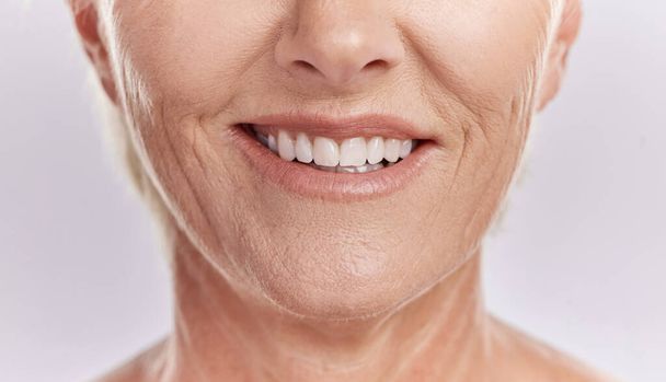 Ευτυχισμένη γυναίκα με δόντια και χαμόγελο, που δείχνει τα φυσικά της δόντια να ποζάρουν πάνω σε ένα πορφυρό φόντο στούντιο. Μοντέλο γυναίκα ικανοποιημένη με την υγιεινή της στοματικής υγείας και την περιποίηση της υγείας της. - Φωτογραφία, εικόνα