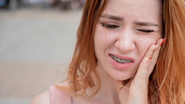 Young red-haired woman with braces suffering from pain - Фото, изображение