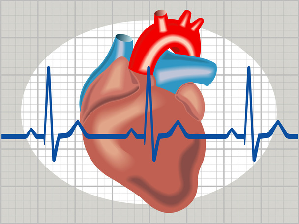 Cardiac arrhythmia - Vector, Image