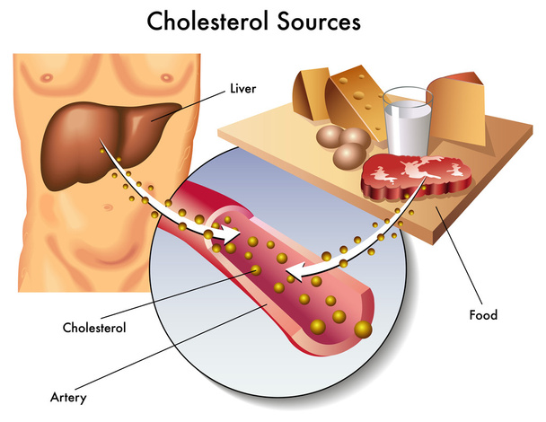 Cholesterol - Vektor, obrázek