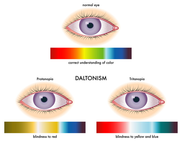 Daltonismo
 - Vector, Imagen