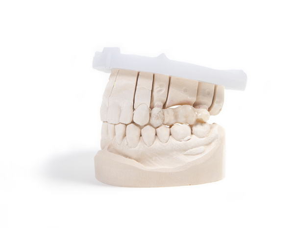 teeth denture - Φωτογραφία, εικόνα