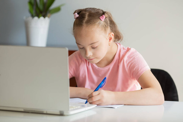 A girl with Down syndrome does her homework at home, prepares her hand for writing, prepares to go back to school. Working out while sitting at a laptop - Zdjęcie, obraz