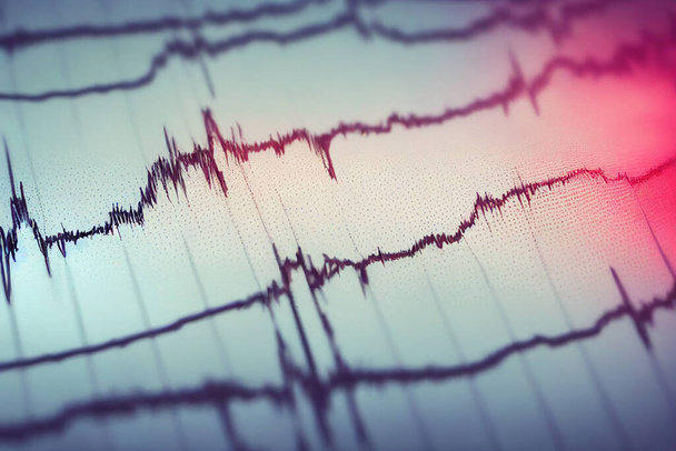 Электрокардиограмма, ЭКГ, монитор сердечного ритма, показывающий конкретное заболевание в больничной палате для проверки сердечного ритма госпитализированных пациентов - Фото, изображение