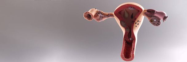 Detailní záběr anatomického modelu dělohy a vaječníků, ženských reprodukčních orgánů. Zdravý ženský reprodukční systém, medicína, koncepce početí, koncepce vzdělávání - Fotografie, Obrázek