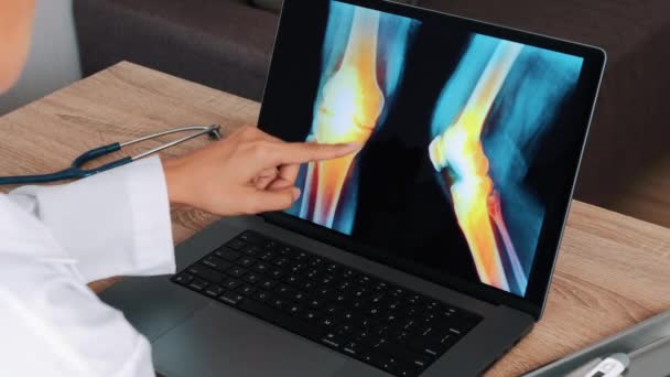 Vrouwelijke dokter toont röntgenfoto met pijn in de knieën en benen op een laptop. Uitzicht boven de schouder. Hoge kwaliteit 4k beeldmateriaal - Video
