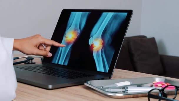 Γυναίκα Γιατρός δείχνει ακτινογραφία με πόνο στα γόνατα σε ένα φορητό υπολογιστή. Από αριστερά προς τα δεξιά. Υψηλής ποιότητας 4k πλάνα - Πλάνα, βίντεο