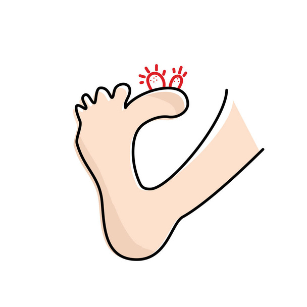Plantar wart icon. Verruca symbol, foot corn, human papillomavirus sign, HPV infection, clavus pictogram, feet papilloma vector illustration - Vector, Imagen