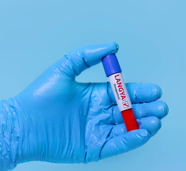 Doctor holding a test blood sample tube positive with Langya henipavirus (LayV).The virus is transmitted from animals to humans. Infected people suffer from fever, cough, headache, nausea and vomiting - Fotó, kép