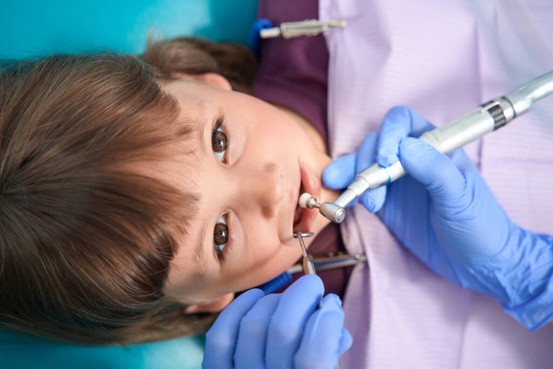 Pediatric dentist applying white bristle dental polishing brush on little girl tooth enamel - Foto, Imagem