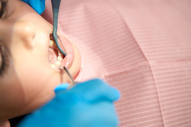 Pedodontist in nitrile gloves inspecting teeth and gums of female child with mouth mirror - Photo, image