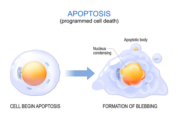 Apoptosis. programmed cell death. aging process in cells. Structural changes of ageing and senescent cells from normal cell to final stage of formation of membrane blebbing. Vector illustration - Vector, afbeelding