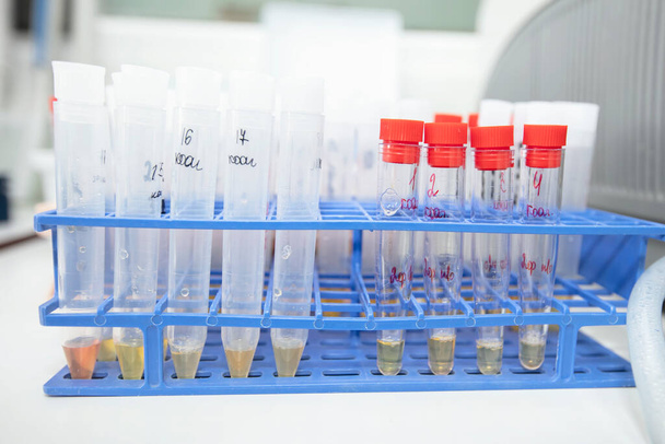 Medical test tubes with urine tests in a biochemical laboratory. - Fotoğraf, Görsel