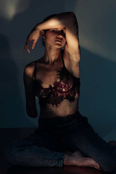 Beautiful young woman with amputee arm and scars from burn on her body poses in lacy bra. The concept of a fulfilling life of persons with disabilities. - 写真・画像