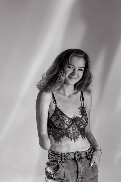 Smiling young woman with amputee arm and scars from burn on her body poses in lacy bra. The concept of a fulfilling life of persons with disabilities. Black and white image. - 写真・画像
