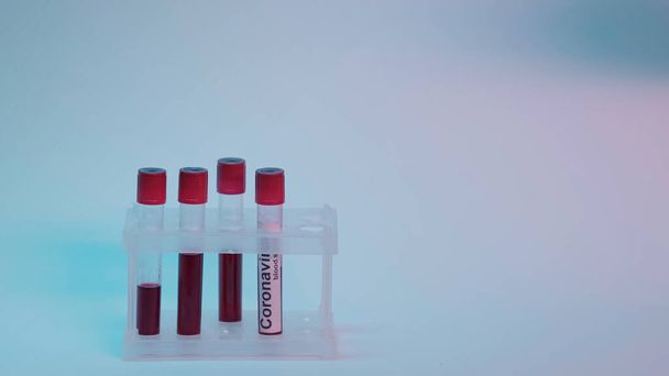 test tubes with blood samples with coronavirus lettering inside of test tube rack on grey and blue background - Valokuva, kuva