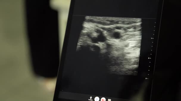 Sonography of a human ultrasound scan in a diagnostic center - Video