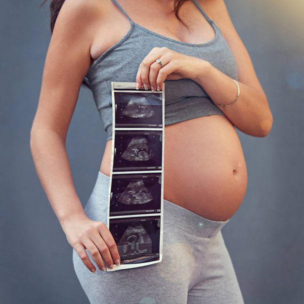 Babys first picture. a pregnant woman holding her sonogram picture against a gray background - Zdjęcie, obraz