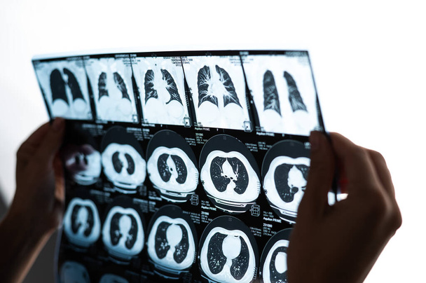 A female doctor examines an MRI scan of the internal organs. Abdomen - Foto, imagen