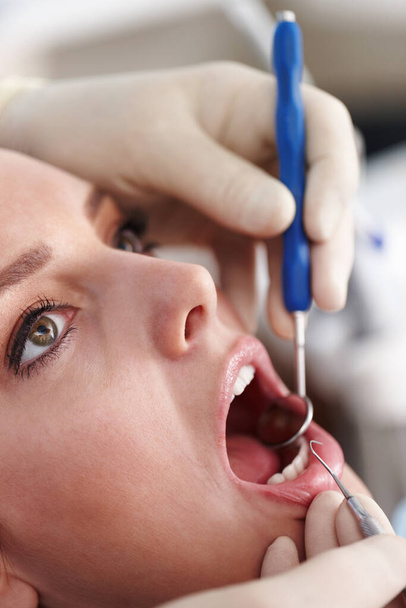Úklid zubů. Detailní záběr pacientky na klinice pro stomatologické ošetření - Fotografie, Obrázek