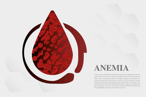 Медицинская векторная иллюстрация анемии Железо красные кровяные тельца. - Вектор,изображение