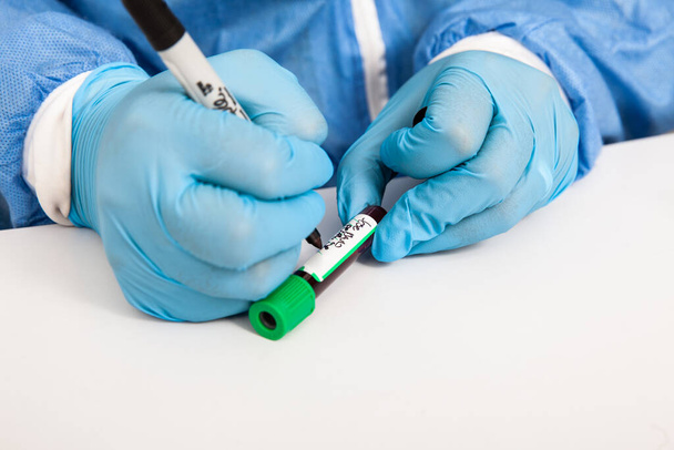 Primer plano de un enfermero etiquetando un tubo de ensayo con una muestra de sangre en un laboratorio clínico - Foto, Imagen