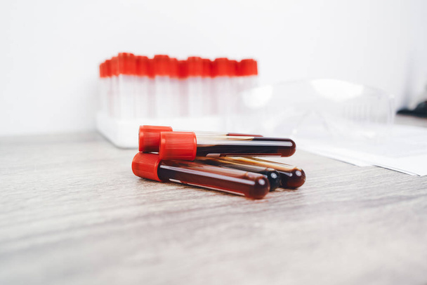 A blood test sample tube pile with a red cap on desk in the hematology lab,  hematology healthcare laboratory concept - Valokuva, kuva