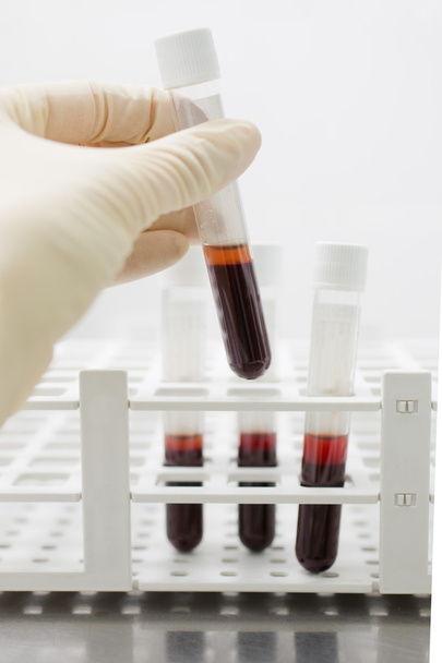 Examination blood samples - 写真・画像