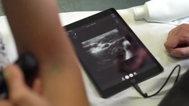 El médico hace una ecografía en un brazo de un hombre en un hospital haciendo diagnósticos de salud - Imágenes, Vídeo