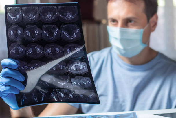 Arzt untersucht den MRI-Scan des Patienten genau - Foto, Bild