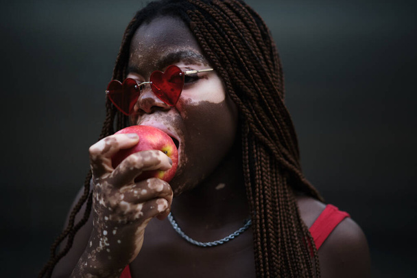 Vista de cerca de una mujer joven con vitiligo usando gafas de sol y mirando a la cámara mientras muerde y come una manzana. - Foto, Imagen