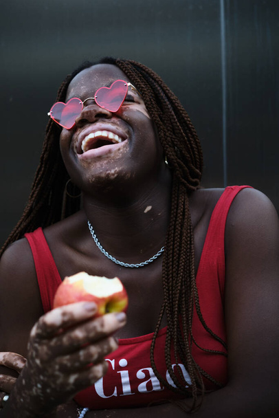 Femme afro-américaine avec vitiligo portant des lunettes de soleil et riant tout en tenant une pomme mordue. Concept de saine alimentation et mode de vie. - Photo, image
