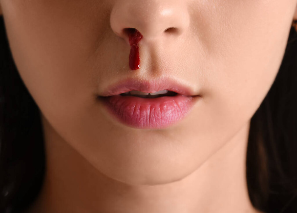 Young woman with nosebleed, closeup - Photo, Image