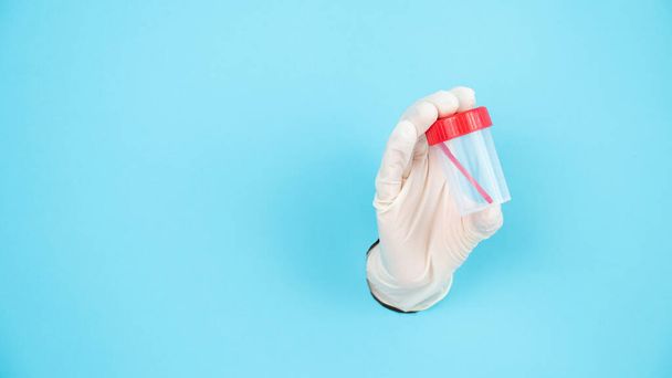 A womans hand in a rubber glove sticks out through a blue paper background and holds a container for collecting feces - Foto, Imagen
