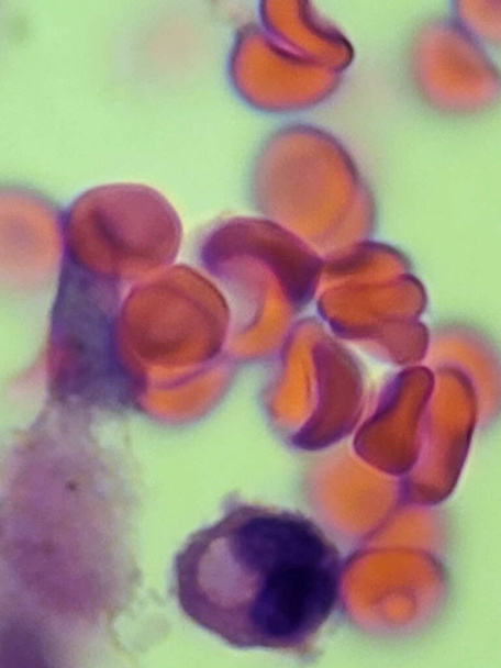 Эритроциты и нейтрофилы на периферическом мазке крови. - Фото, изображение