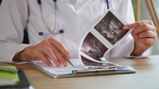 gynecologist examines ultrasound of uterus of patient. Female reproductive system and infertility - 写真・画像