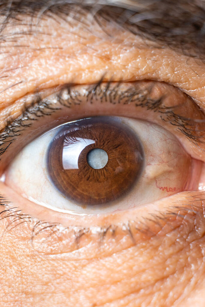 白内障を持つ高齢者の目レンズの雲マクロ - 写真・画像