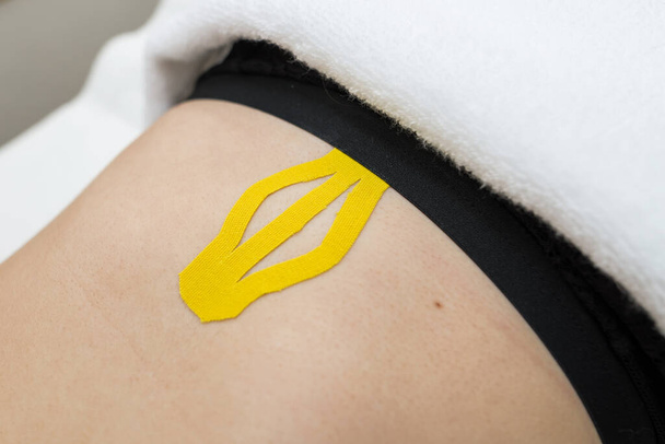 kinesio tape on the abdomen of a young woman - Fotografie, Obrázek
