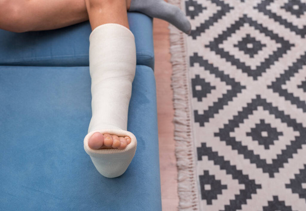 Gebrochenes Bein. Knöchel- und Fußschienen-Bandagen an den Beinen. Nahaufnahme - Foto, Bild
